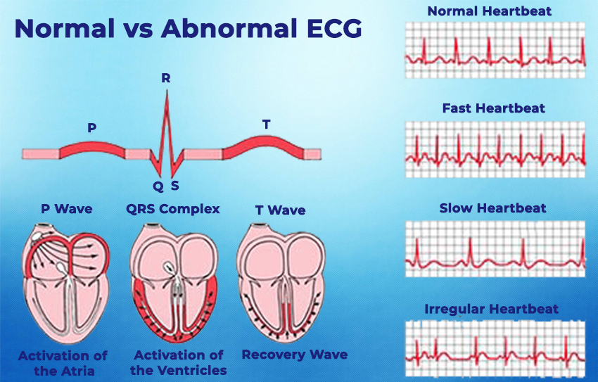 Echocardiography and ECG