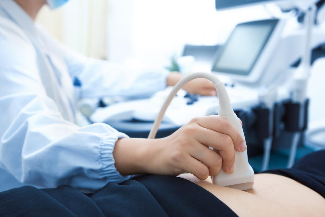 Ultrasound USG Services