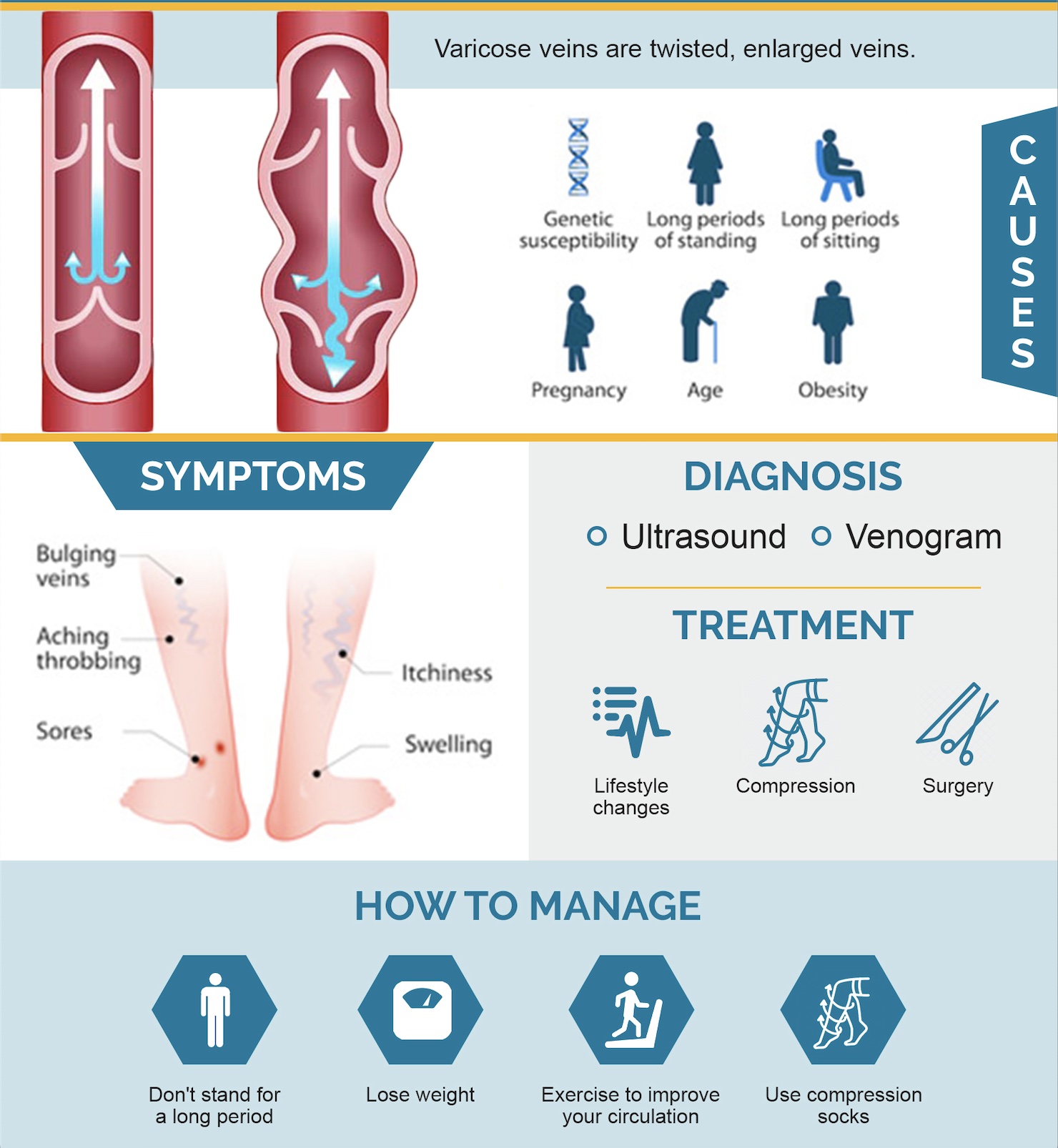 Varicose Vein Treatment Service in Virar
