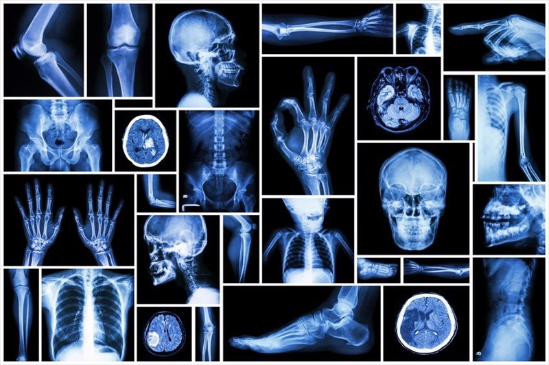 X-ray Diagnostic Services